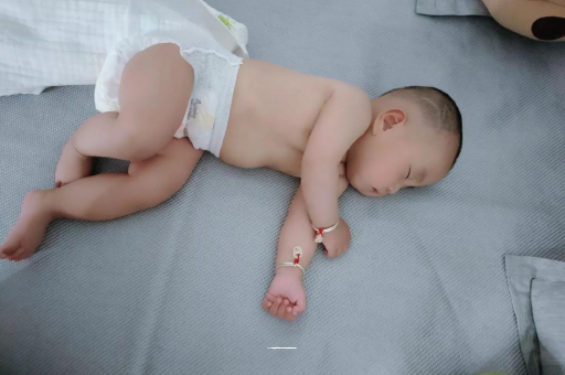 龙口六个月宝宝眼睛散光